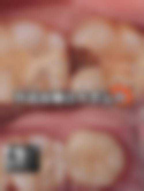 【天水卫康口腔门诊部 价格表参考】