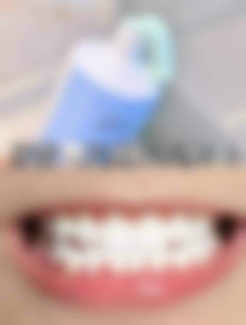 【新疆昌吉瑞杨32颗口腔常见问题解答】