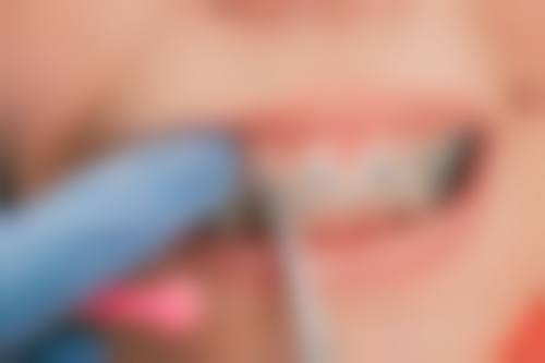【泰州靖江文蕙口腔门诊部常见问题解答】