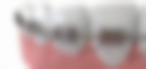 【广东东莞莞微口腔特色诊疗项目】