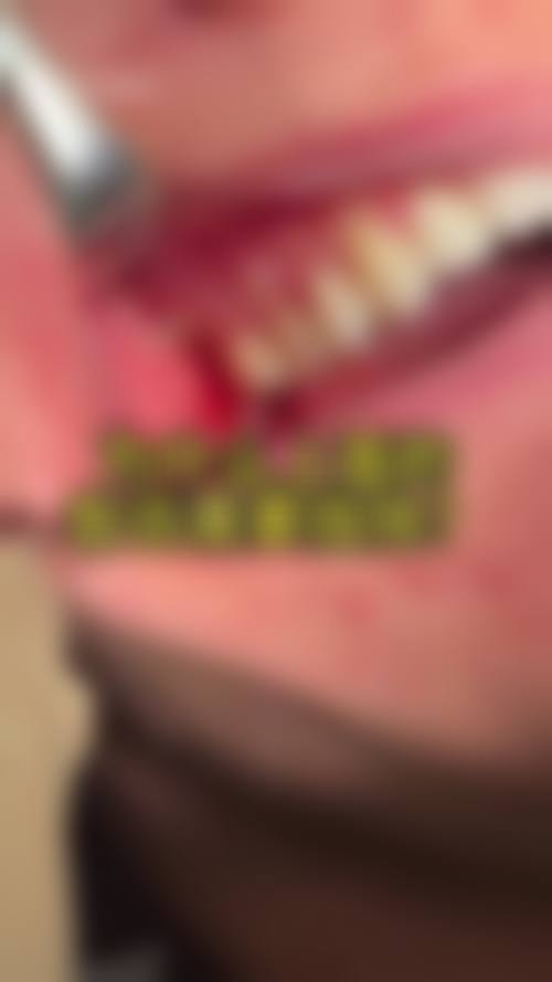 【苏州启航口腔价格表参考】
