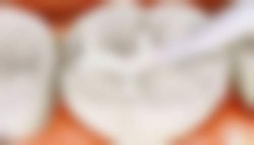 【深圳冷伟琪口腔诊所参考价格表】