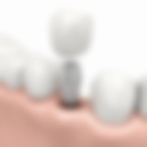 【佛山鼎植口腔(金沙湾店)真实口碑评价】