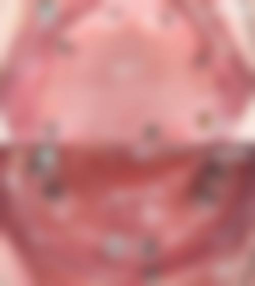 【咸宁市中医医院口腔科特色诊疗项目】