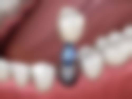【福建泉州许素娴口腔真实口碑评价】