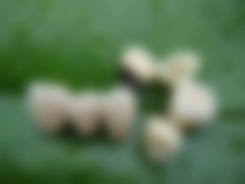 【邯郸市第一医院口腔科参考价格表】