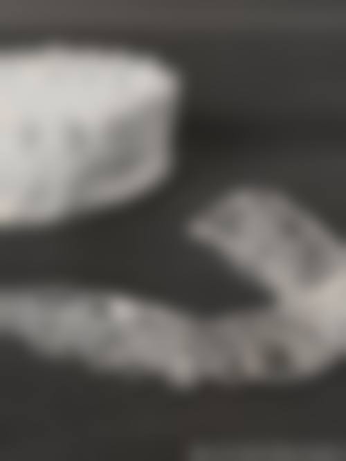 【陕西商洛山阳县爱牙口腔参考价格表】