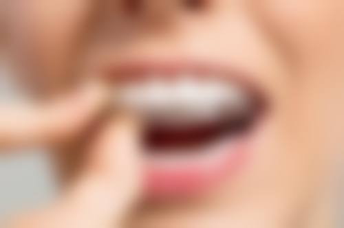 【陕西商洛山阳县爱牙口腔骨干医生团队与技术标准】