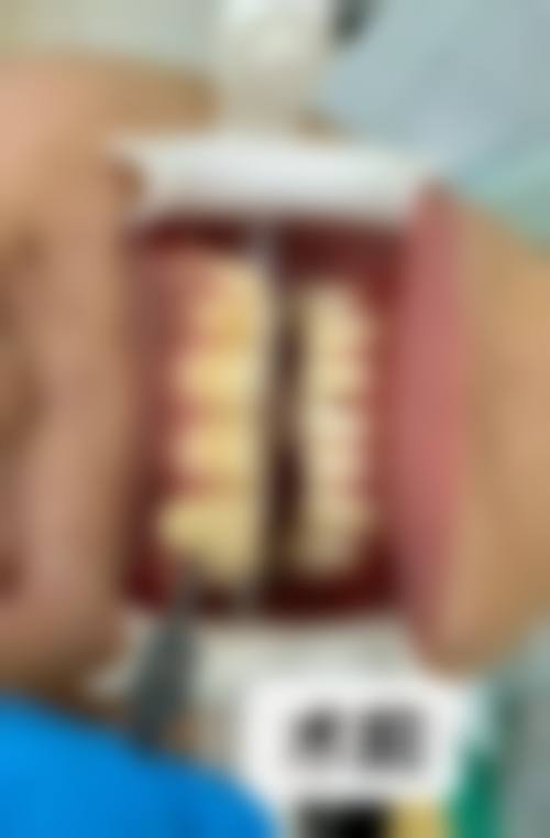 【中胜口腔门诊部参考价格表】
