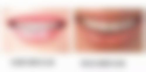 【博亚口腔门诊部预约挂号方式与流程】