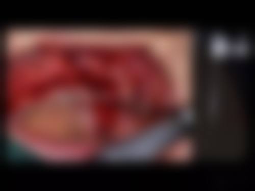 【重庆市綦江区人民医院口腔科常见问题解答FAQ】