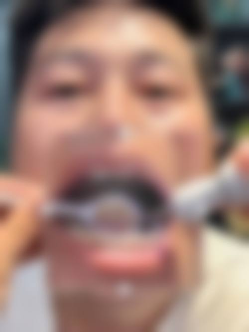【无锡小虎牙口腔参考价格表】