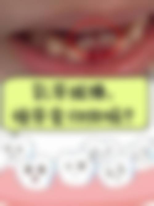 【无锡小虎牙口腔特色诊疗项目】