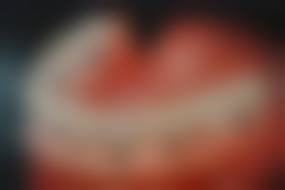 【浙江杭州名赫口腔诊所真实口碑评价】