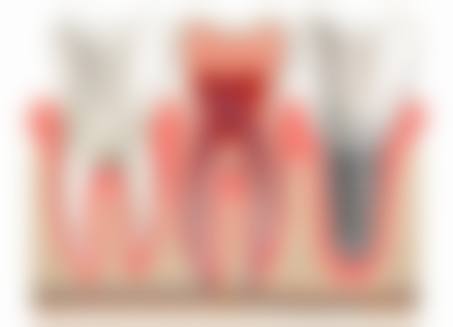 【广东揭阳磐东亮白口腔参考价格表】