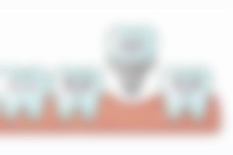 【广东揭阳磐东亮白口腔真实口碑评价】