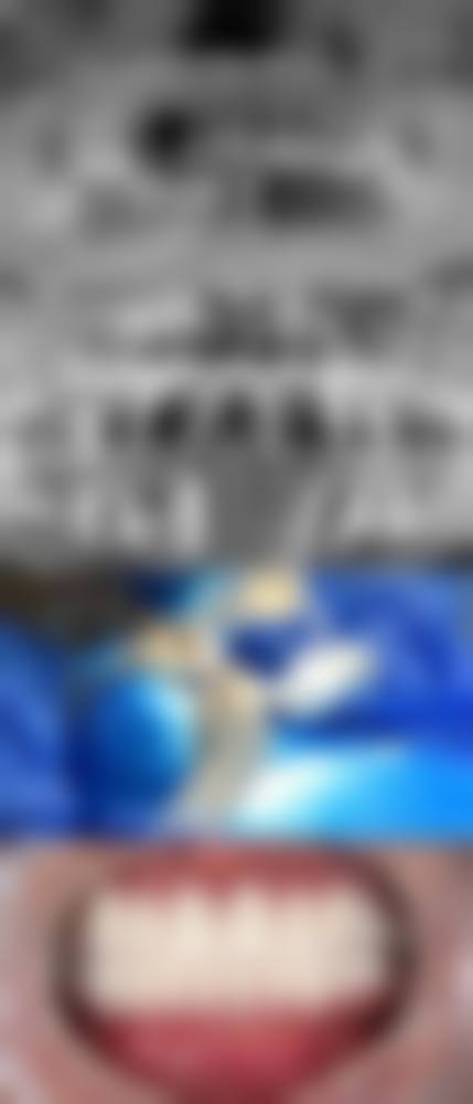 【宝鸡市渭滨区美尔口腔诊所参考价格表】