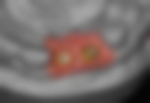 【吉安思迈尔口腔预约挂号方式与流程】