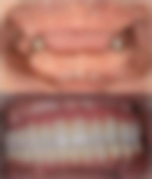 【天津东丽洁皓口腔诊所真实口碑评价】