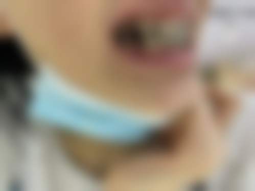 【无锡洁雅口腔门诊部预约挂号方式与流程】