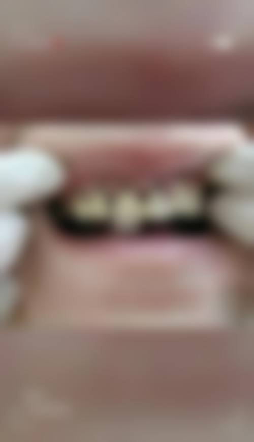 【深圳友睦三九口腔门诊部前列技术设备与院感环境】