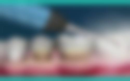 【肇庆四会瑞尔口腔特色诊疗项目】