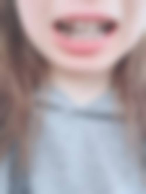 【河南平顶山湛河益齿宁口腔参考价格表】