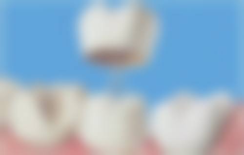 【天津康齿美口腔门诊部参考价格表】