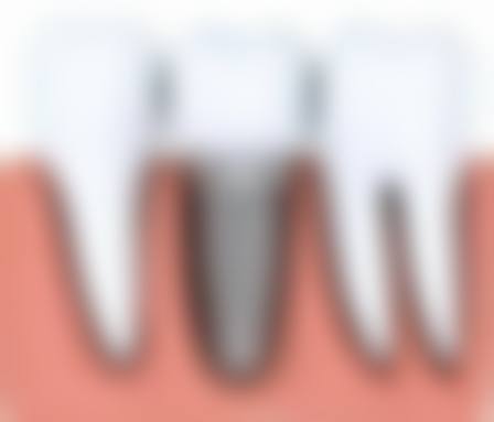 【广东广州索罗斯口腔参考价格表】