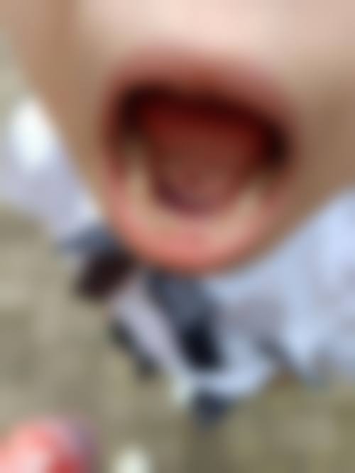 【阳泉皓瑞齿科口腔诊所参考价格表】