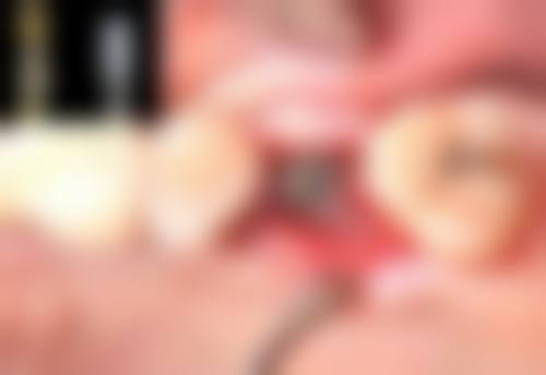 【深圳卓悦东进口腔门诊部真实口碑评价】