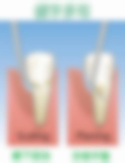 【柳州牙管家口腔门诊部预约挂号方式与流程】