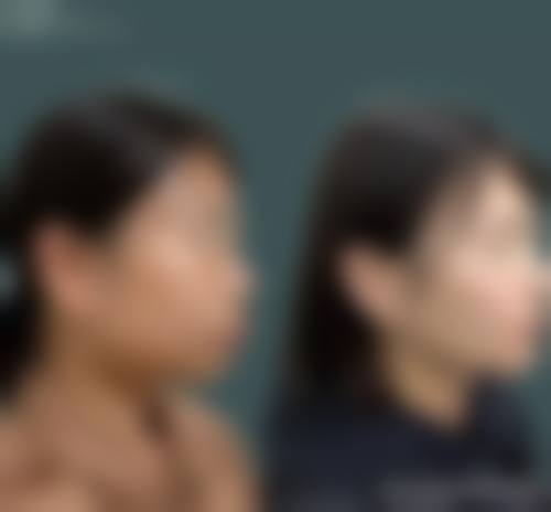 【长沙贝诺医院口腔科预约挂号方式与流程】