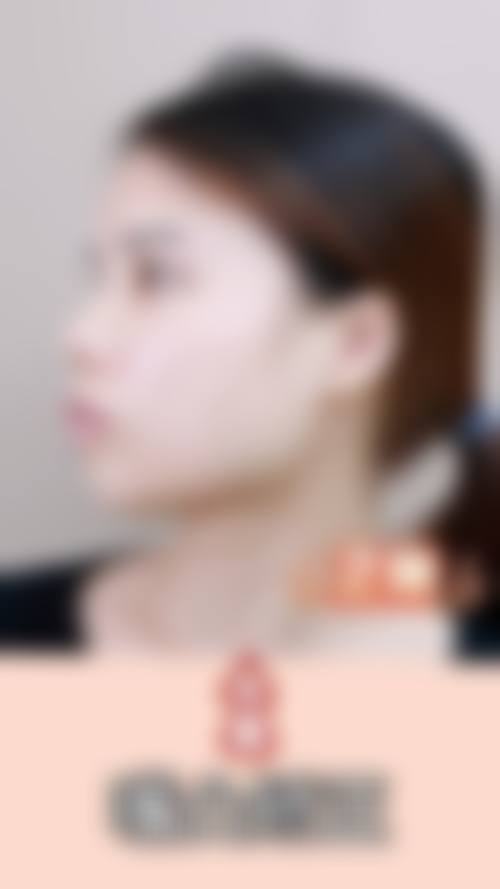 【长沙贝诺医院口腔科参考价格表】
